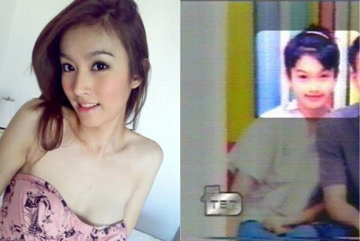 after sex change operation after sex change operation
