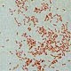 Escherichia Coli Escherichia Coli