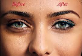 Effective Home Remedy for Dark Circles: eAskme