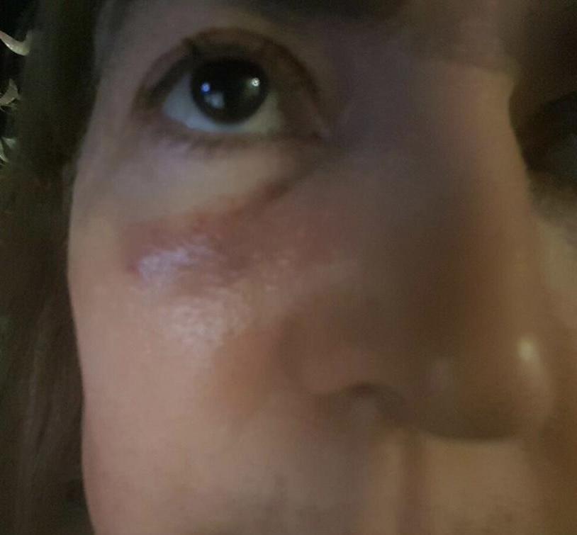 Close up of a person's face

Description automatically generated