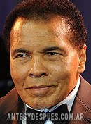 Muhammad Ali,  