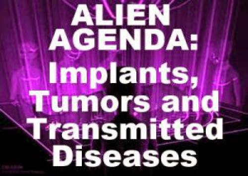 Alien Agenda Implants Tumors And Transmitted Diseases