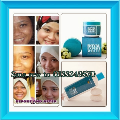 Testimoni royal expert white, produk penjagaan muka terbaik Testimoni royal expert white, produk penjagaan muka terbaik