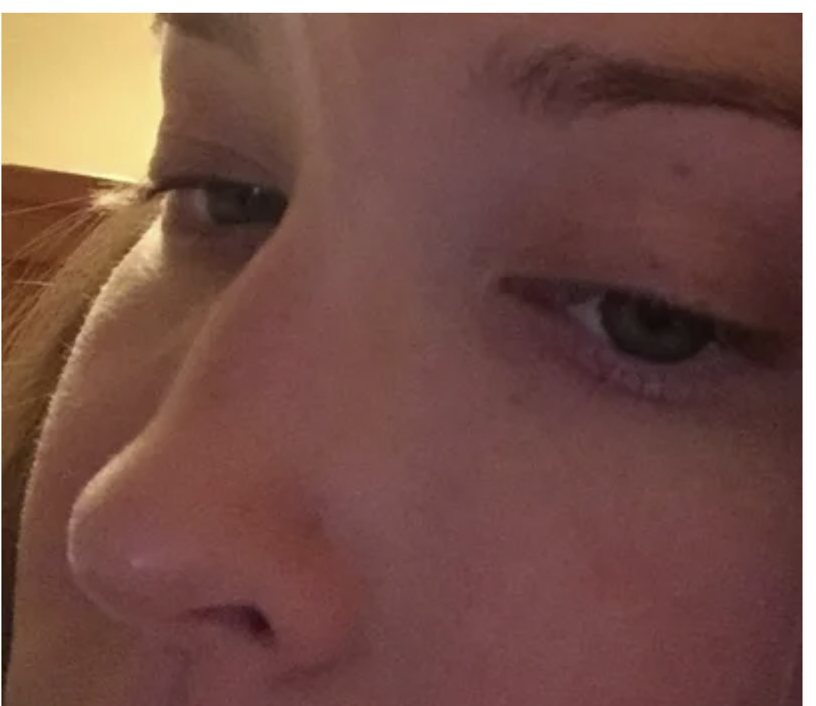 Dallas Rhinoplasty Center review