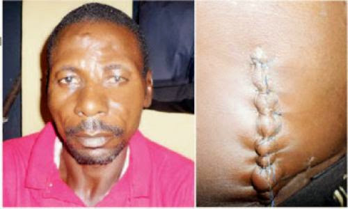 I Killed My Wife To Stop Her From Infecting People With Hiv Man Tells Police