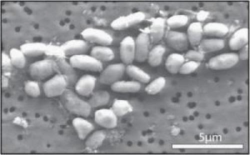 The Great Nasa Disappointment Of 2010 Bacteria Not Extraterrestrials