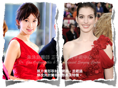 削骨手術,下顎骨雕塑,下巴,林志玲,Ann Hathaway