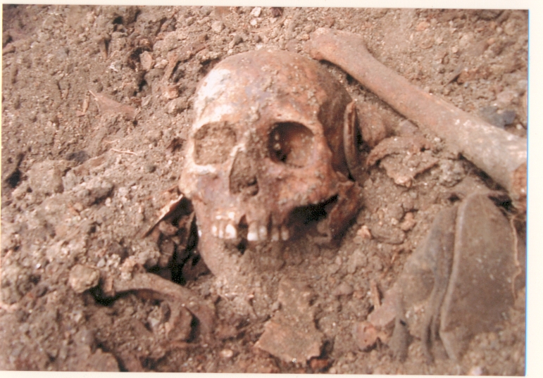 Розкопки масових могильників репресованих на 6-му км Овідіопольської дороги (Одеса)