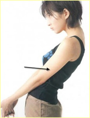 Observar forma de brazo en hombro Observar forma de brazo en hombro