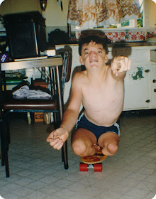 Robert Hoge as a young boy on a skateboard 