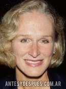 Glenn Close, 1992 