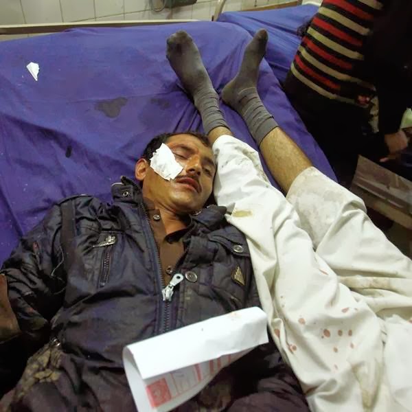 Men, who were injured in explosions, lie on a bed after they brought to the Lady Reading hospital for treatment in Peshawar.