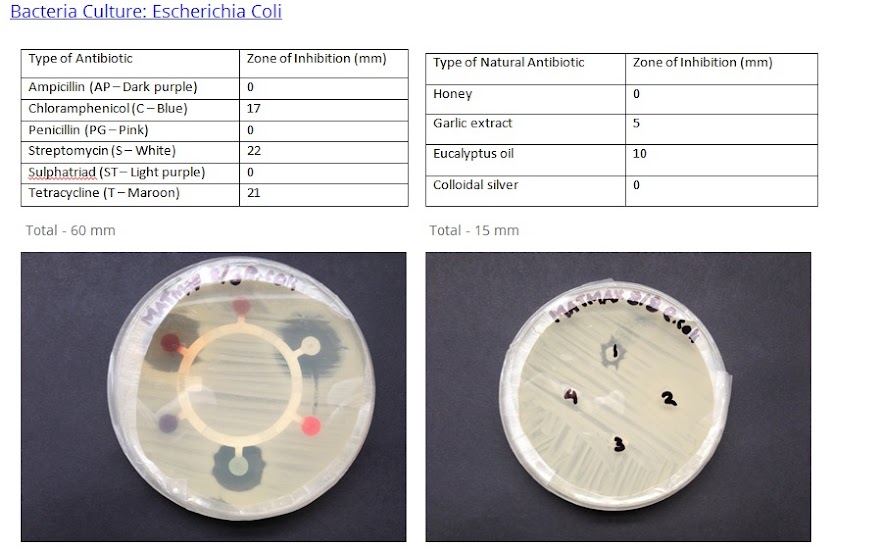 Badania in-vitro właściwości antybiotycznych wybranych gatunków roślin