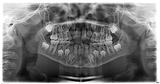 Dentodigital Metepec, #701-B int. 11, Av Leona Vicario 701B, La Purisima, 52140 Metepec, Méx., México, Servicio de urgencias dentales | HGO