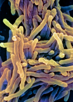 B2201310 Tuberculosis bacteria%252C SEM SPL Foto foto hasil scanning mikroskop elektron