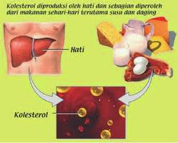 Cara Mengatasi Kolesterol Tinggi
