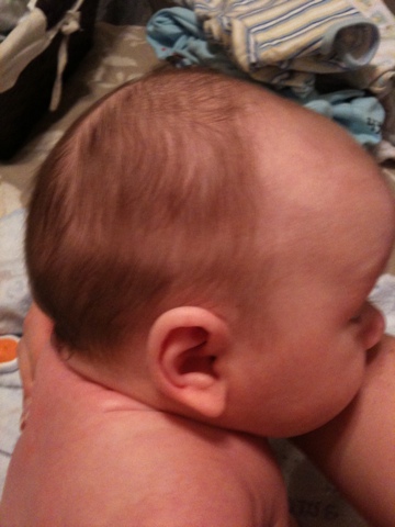 newborn  Hair thinning on 35 months old  Parenting Stack Exchange