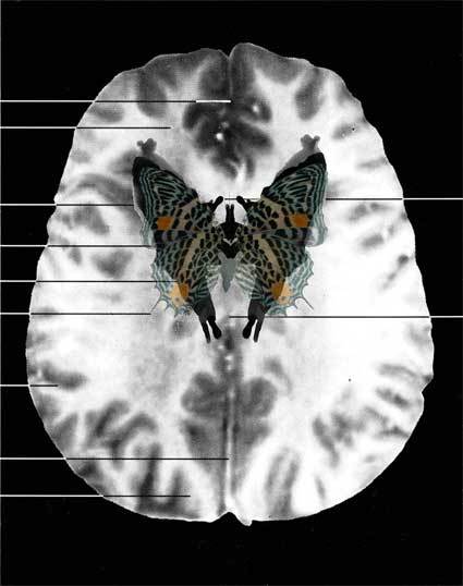 Image result for suzanne anker fMRI butterflies