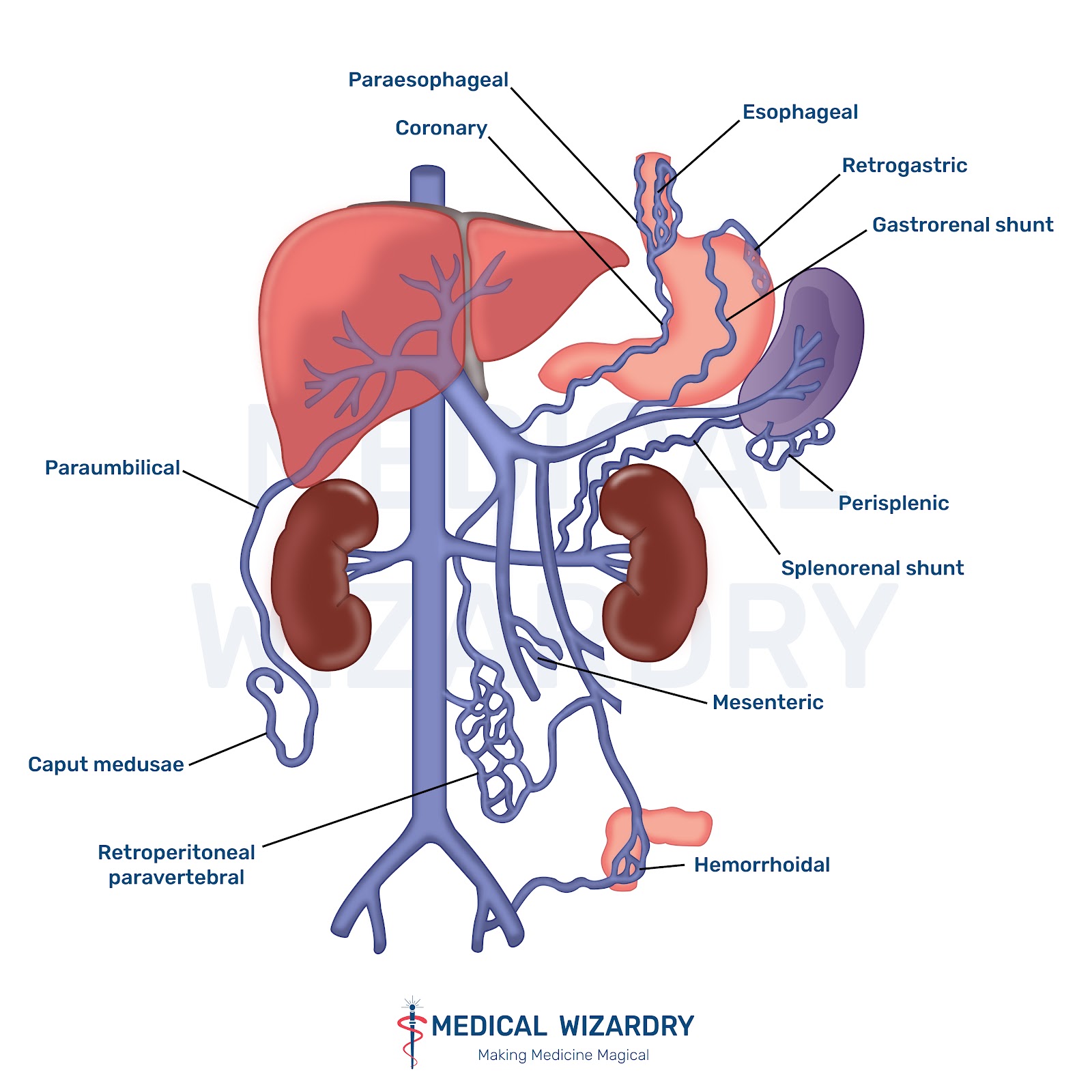 Portal Hypertension