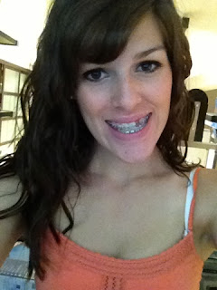 can you still hook up with braces Did any of you refuse ipr (slenderizing) i would do all the research you can, but still remain open-minded until you can see pics of my teeth in my braces. can you still hook up with braces Did any of you refuse ipr (slenderizing) i would do all the research you can, but still remain open-minded until you can see pics of my teeth in my braces.
