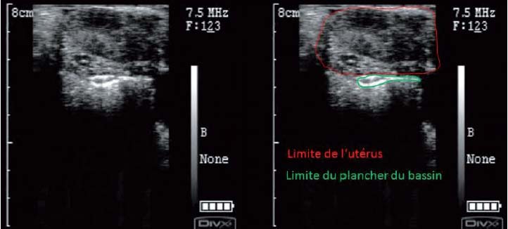 Image échographique de l’utérus d’alpaga