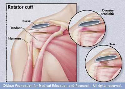 旋轉肌群(Rotator cuff) - 小小整理網站Smallcollation