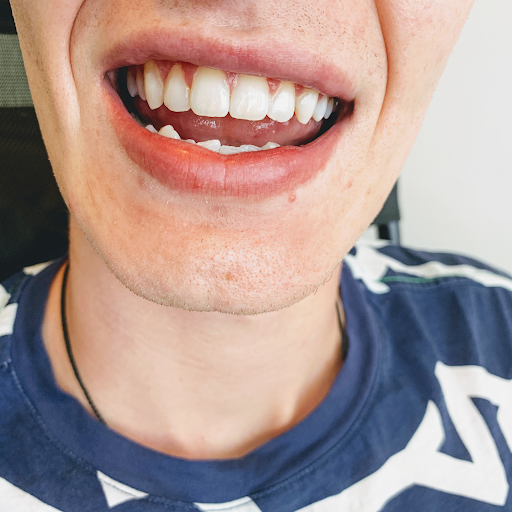 The Teeth Whitening Lab - Christchurch Former Dental Therapist logo
