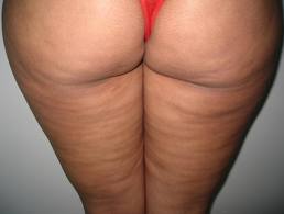 As revistas de nata antes e depois de pigmentary notam respostas