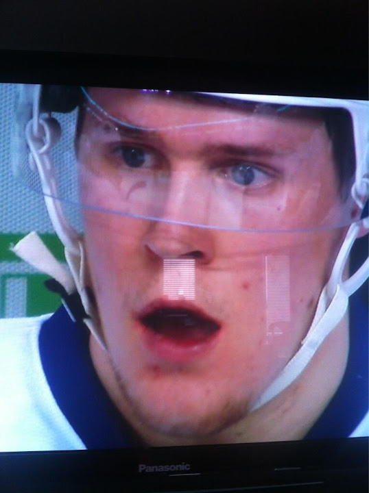 Stunned Maple Leafs: A Compilation