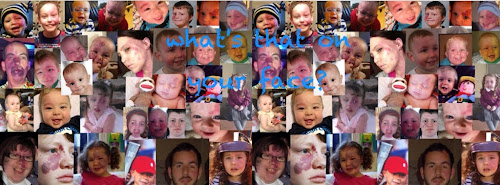 Collage featuring children with visible differences 