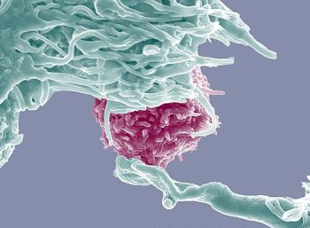 P2660089 Dendritic cell and lymphocyte%252C SEM SPL Foto foto hasil scanning mikroskop elektron