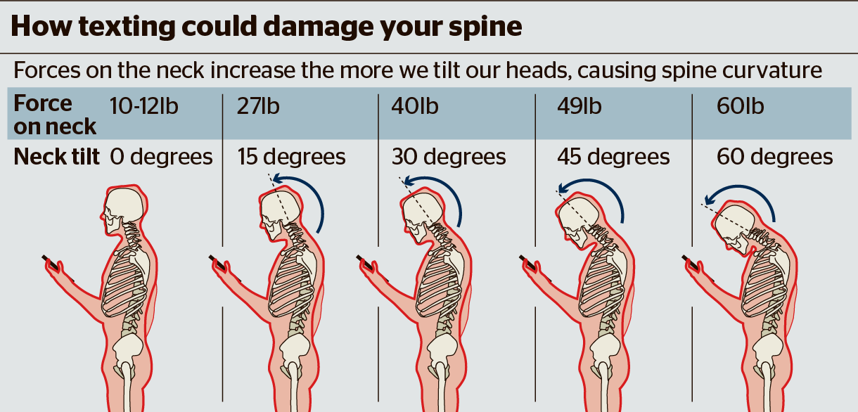 Young Professionals Connection Damaged Spine