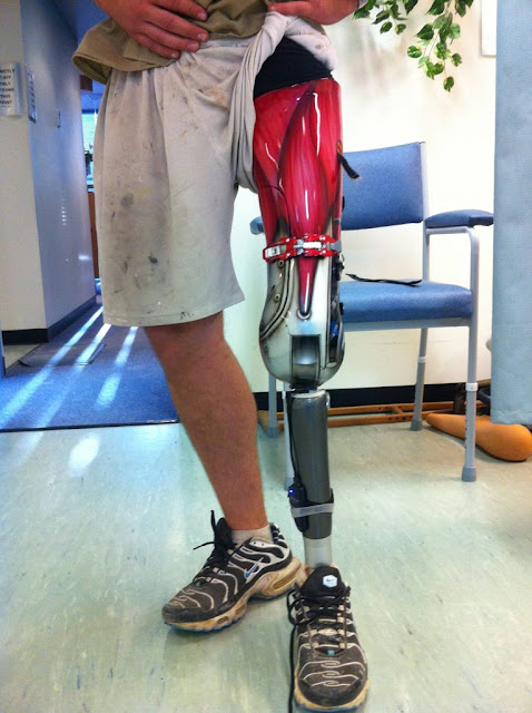 Terminator prosthetic leg/artwork! design
