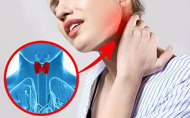 Suy tuyến giáp là gì, suy tuyến giáp có chữa được không?