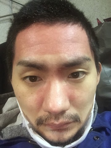 尋常性乾癬 闘い 23