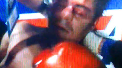 Nonito Donaire TKOs Jorge Arce – Replay Video – 12-16-2012.jpg Nonito Donaire TKOs Jorge Arce – Replay Video – 12-16-2012