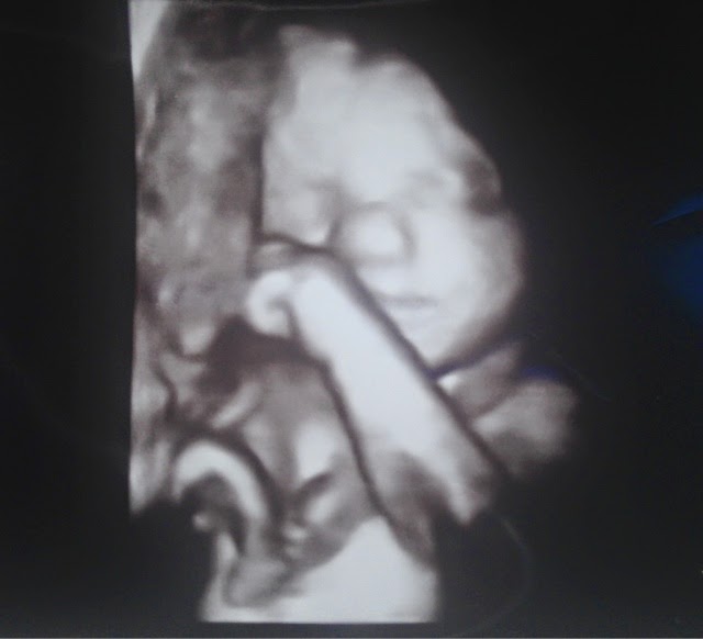 Style The Change 30 Weeks High Kicks And Braxton Hicks