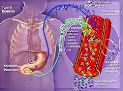 Mirtogenol Dalam Mirtoplus Efektif Untuk Penyembuhan Diabetes