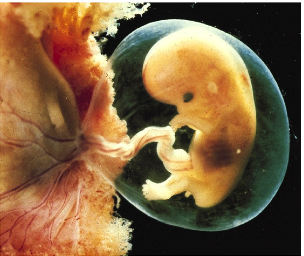 Эмбрион на 7 акушерской неделе беременности. Ребёнок на 7 неделе беременности. Плод на 10 неделе беременности. Ребенок на 6-7 недели беременности. 6 неделя что происходит с малышом