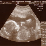 Ultrasounds - April 29, 2008