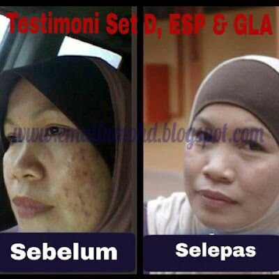 kulit cantik dengan shaklee