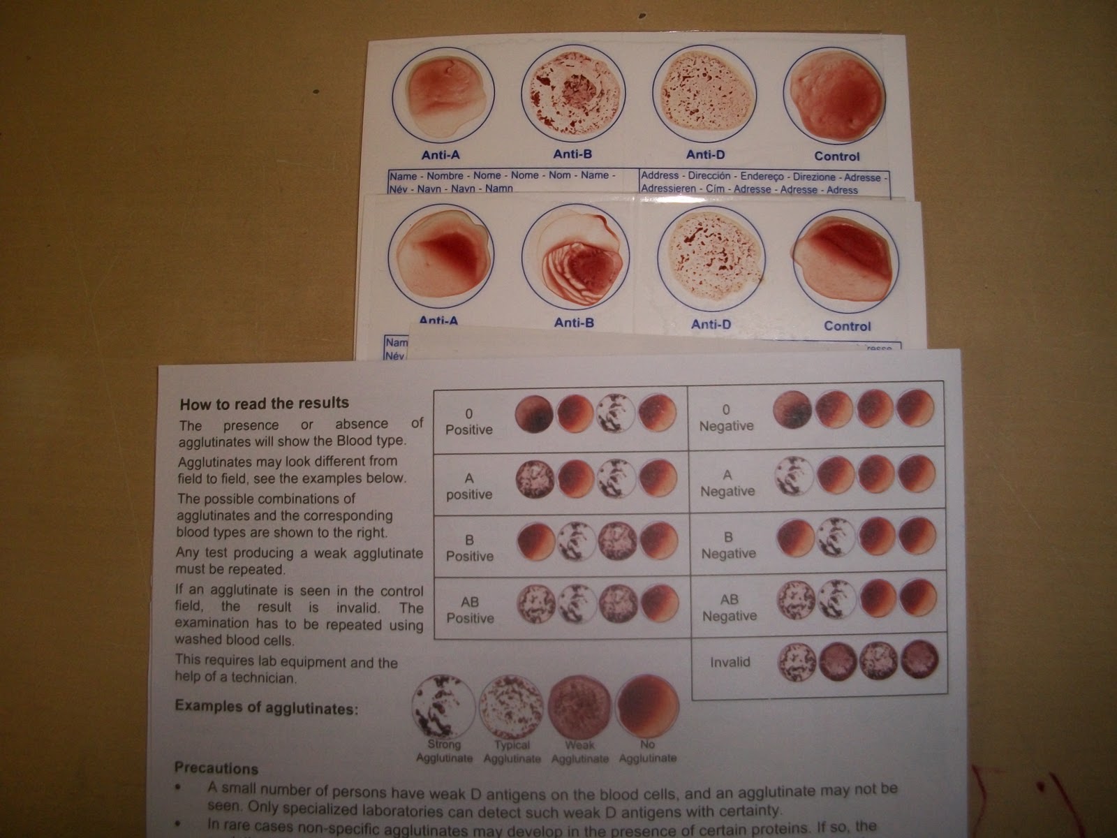 Определите группу крови тест. Инструменты для определения группы крови. Набор для определения группы крови. Планшет для определения группы крови. Посуда для определения группы крови.