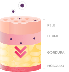 Imagem apresenta as camadas da epiderme (pele, derme, gordura e músculo), a fim de ilustrar as barreiras cutâneas e explicar sobre os ativos nanoencapsulados.