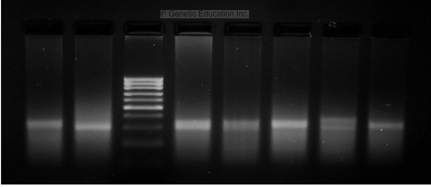 PCR gel electrophoresis result image  4.