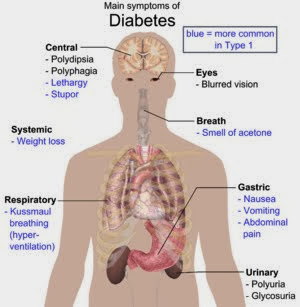 kezelése retinopátia diabetes mellitusban icd 10 type 1 diabetes with complications