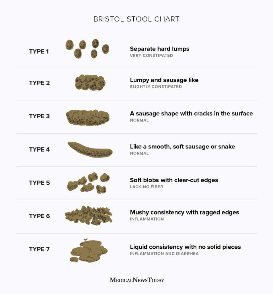 Шкала кала по бристольской шкале. Bristol Stool Scale. Бристольская шкала формы кала. Бристольская шкала стула. Бристольская шкала стула расшифровка.