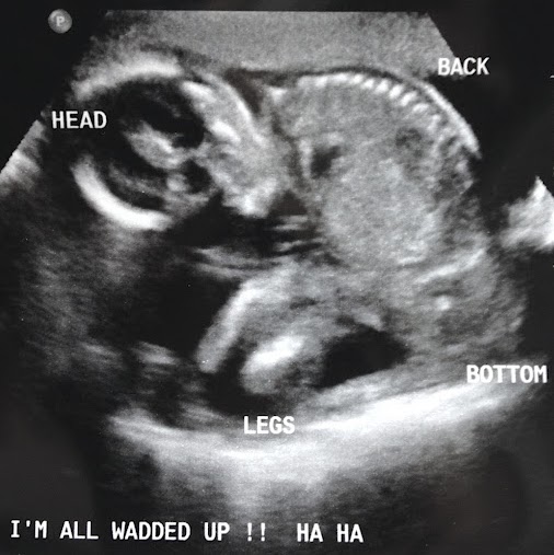 Caroline Hayes Address, Phone Number, Public Records Radaris