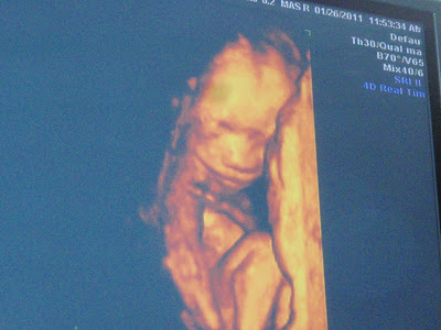 glucose tolerance Glucose Tolerance Test. glucose tolerance
