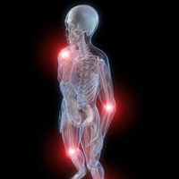Post image for Understanding the Causes of Gout