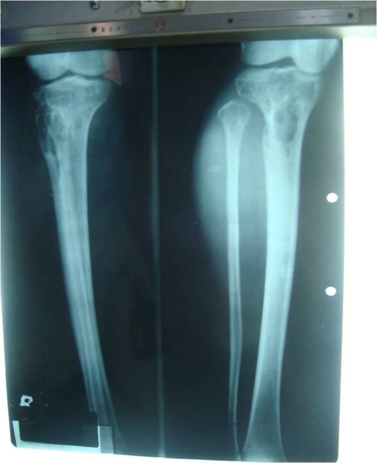 Intan Risna's: Radiologi: Muskuloskeletal & Ekspertise